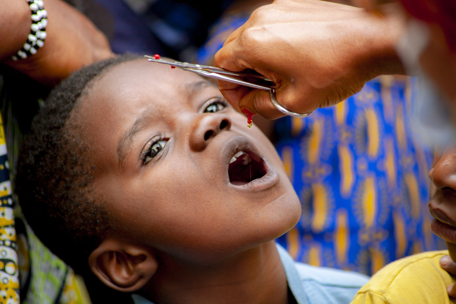School aged child in the DRC opens his mouth while he is administered a dose of vitamin A supplementation from a red capsule.
